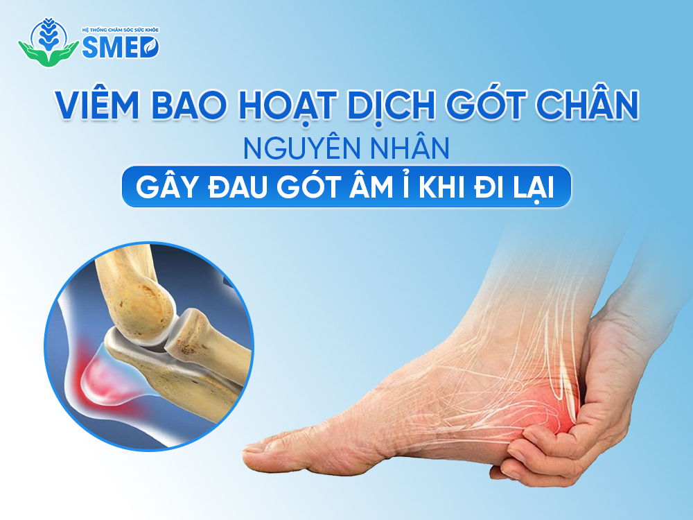 Hình ảnh minh họa gót chân bị đau do viêm bao hoạt dịch gót chân