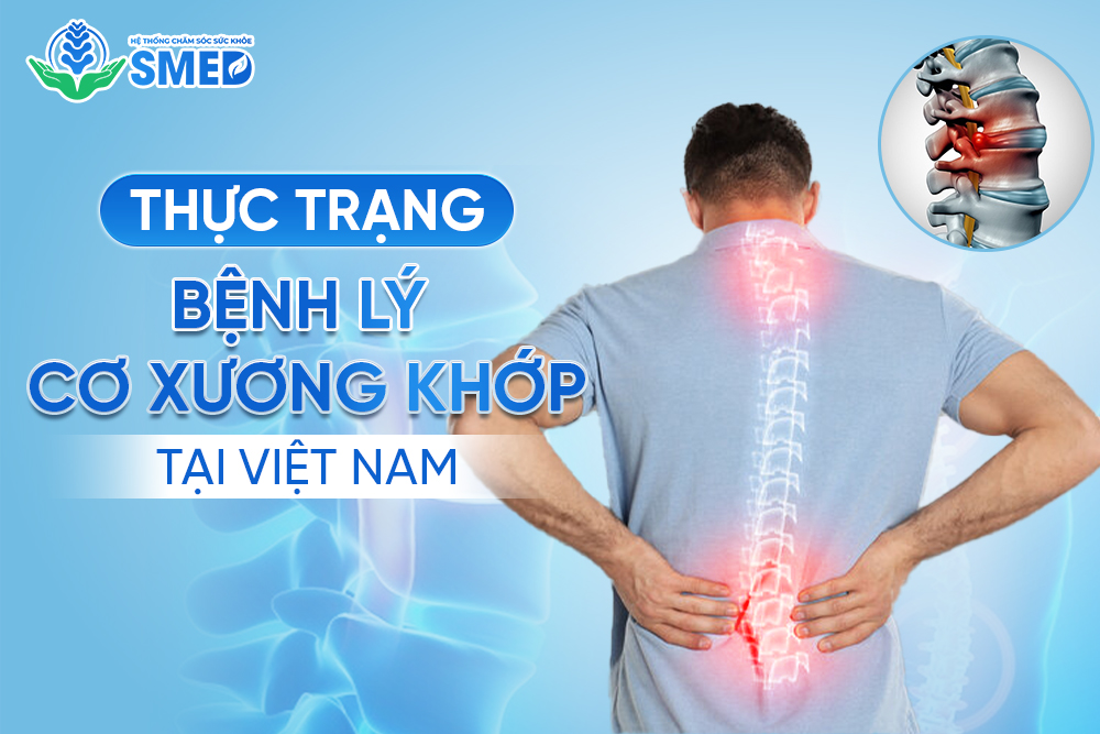 Thực trạng bệnh lý cơ xương khớp tại Việt Nam ngày càng tăng cao 