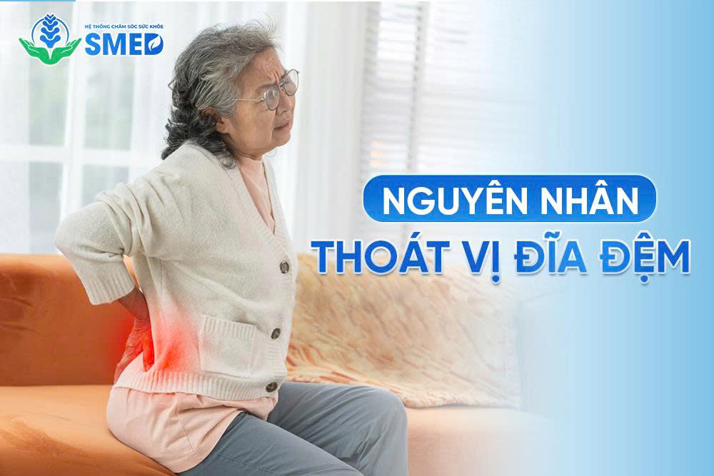 Hình ảnh minh họa nguyên nhân dẫn đến thoát vị đĩa đệm