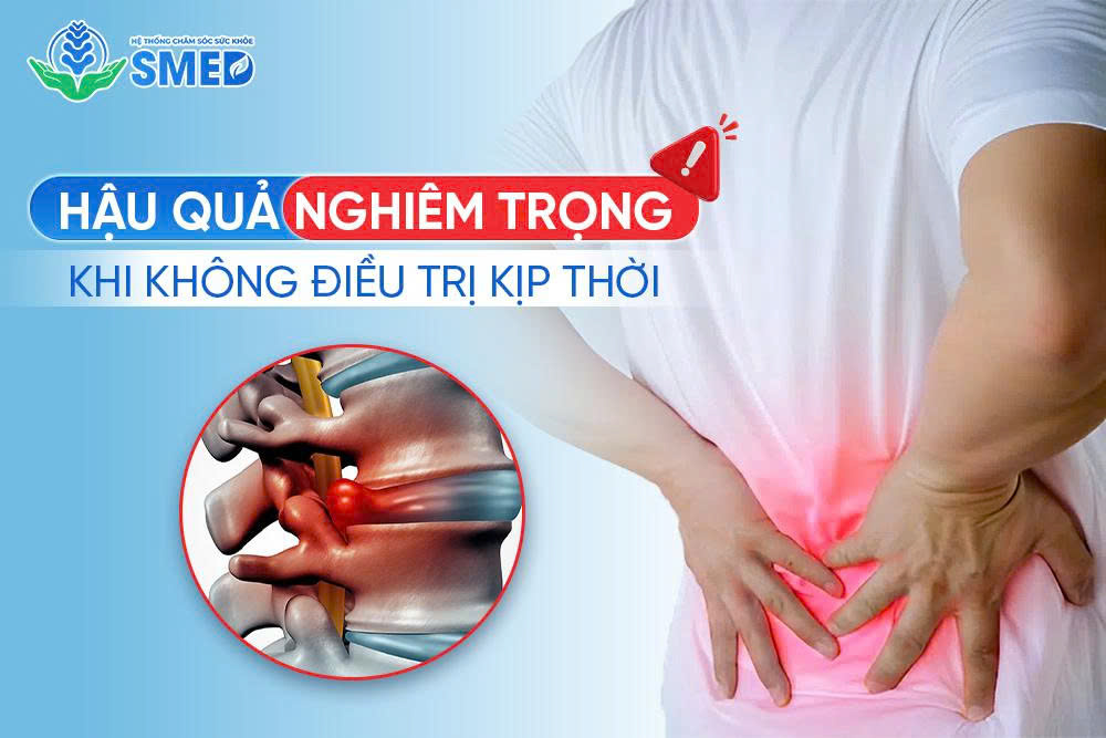 Thoát vị nếu không điều trị đúng cách để lại hậu quả nghiêm trọng