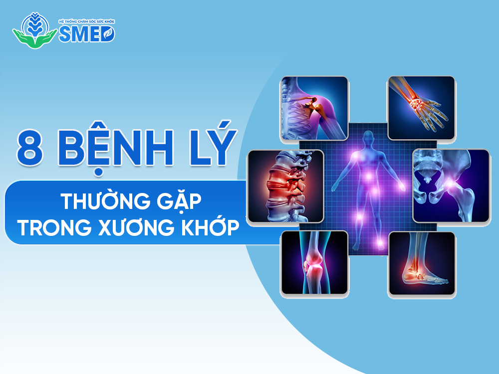 8 bệnh lý cơ xương khớp thường gặp và cách phòng tránh 