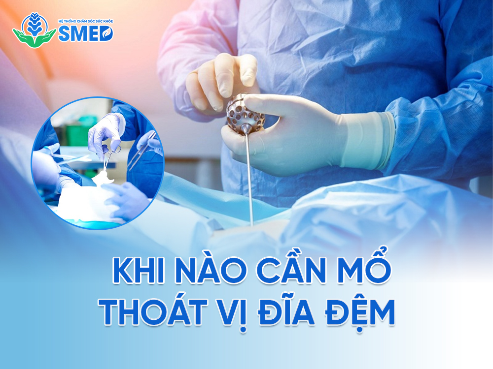 Khi nào thì nên mổ thoát vị đĩa đệm 