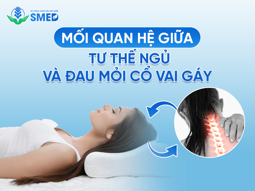Tại sao đau mỏi cổ vai gáy lại liên quan đến tư thế ngủ