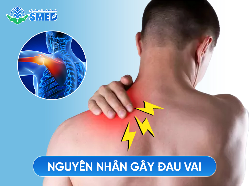 Có 3 nhóm nguyên nhân gây đau vai 