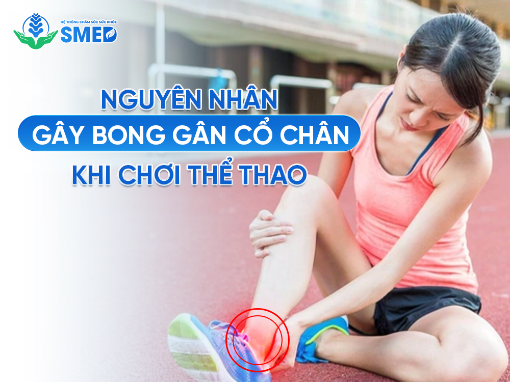 Các nguyên nhân chính gây nên tình trạng bong gân 