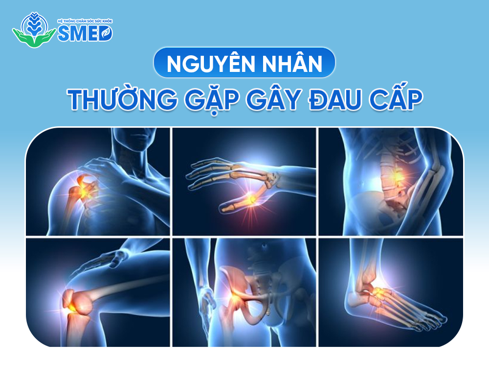 Các nguyên nhân chính gây đau cấp 