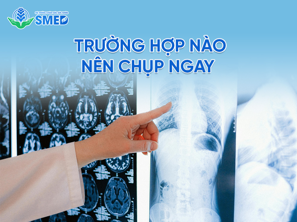 Trường hợp nào thì nên đi chụp ngay 
