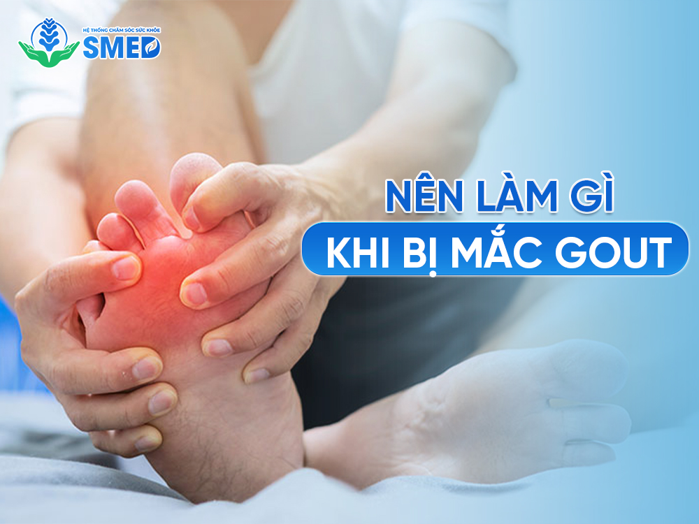 Nên làm gì khi mắc bệnh gout 