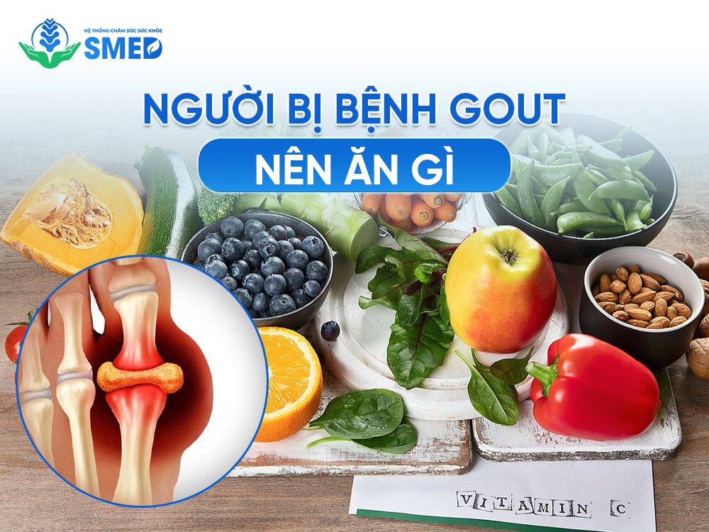 Người bị gout nên ưu tiên ăn các thực phẩm trên 