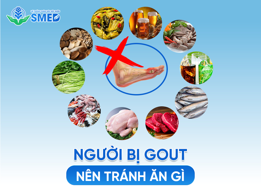Người bị gout nên tránh ăn gì 