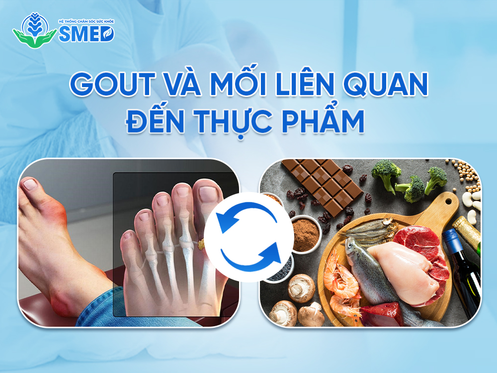 Gout và vai trò dinh dưỡng trong cơ thể con người 