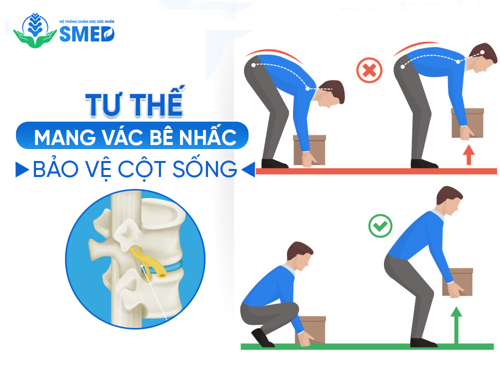 Tư thếmang vác đồ đúng giúp bảo vệ cột sống