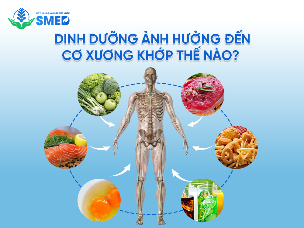 10 món ăn tốt cho xương khớp có ảnh hưởng thế nào đến hệ cơ xương khớp 