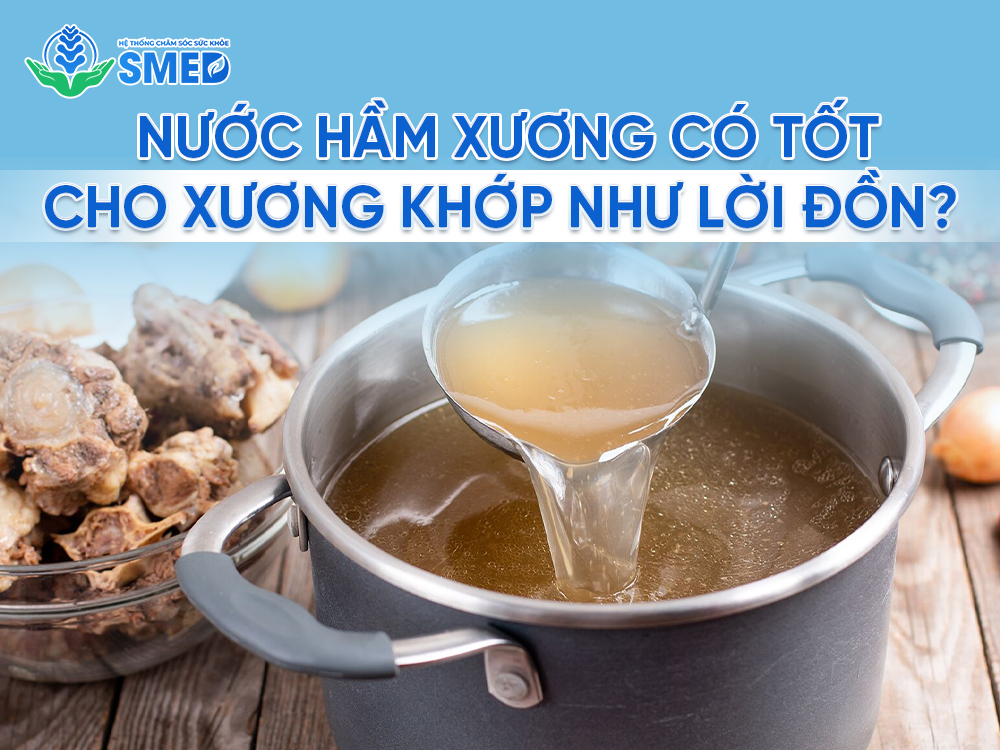 Nước hầm xương có thực sự tốt cho xương khớp như lời đồn không 