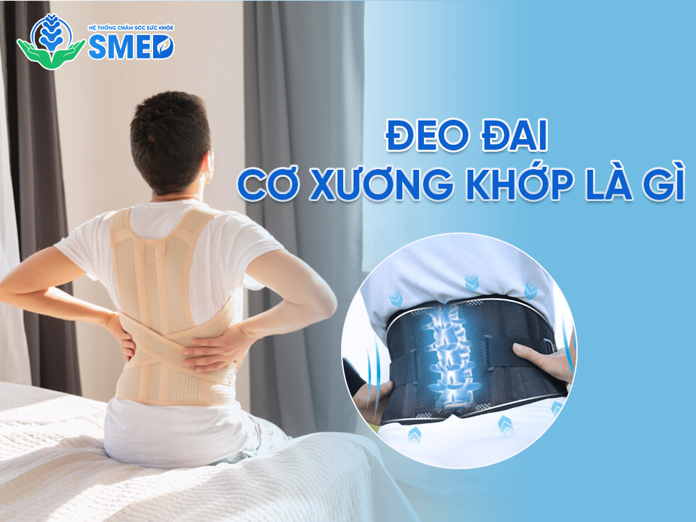 Khái niệm về đeo đai cơ xương khớp là gì? 