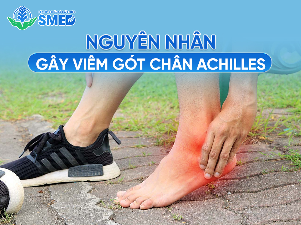 Các nguyên nhân gây viêm gân gót chân Achilles 
