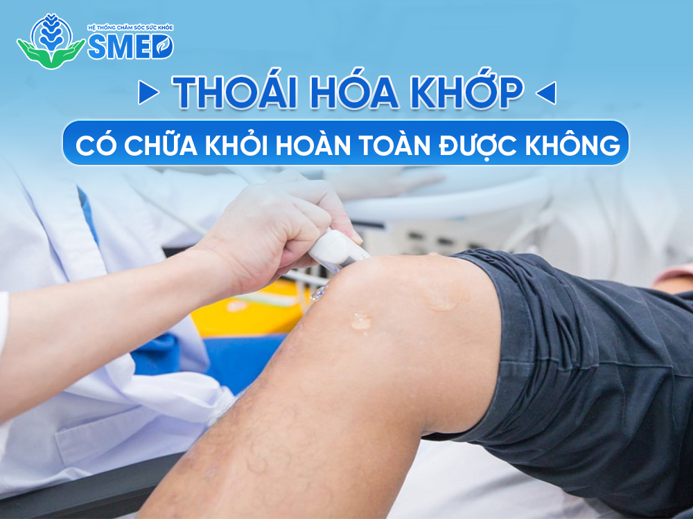 Thoái hóa khớp có chữa khỏi hoàn toàn được không 