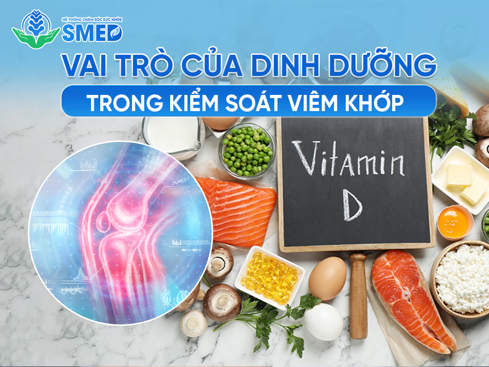 Vai trò của dinh dưỡng trong kiểm soát viêm khớp 