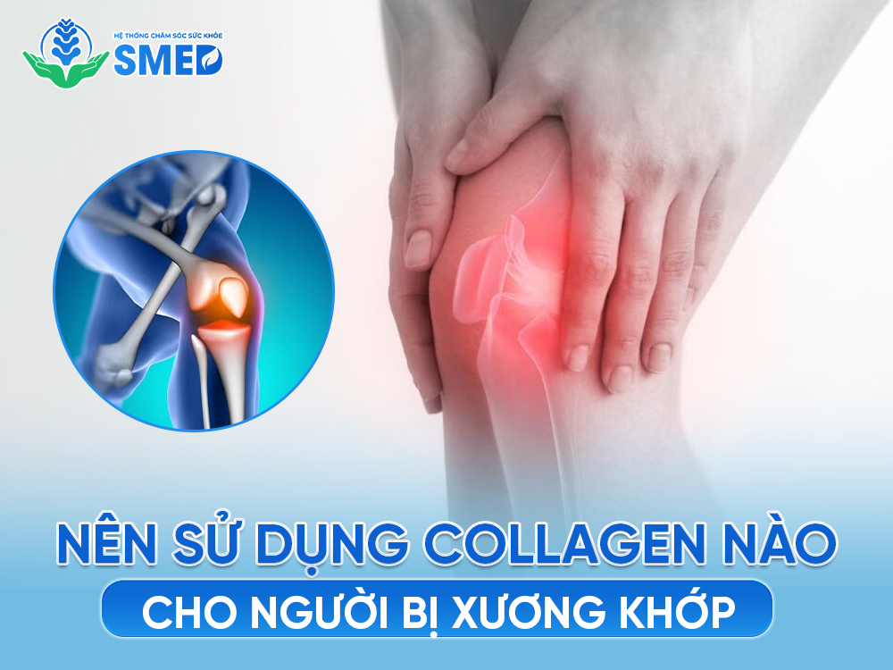 Người bị đau xương khớp nên sử dụng collagen loại nào? 